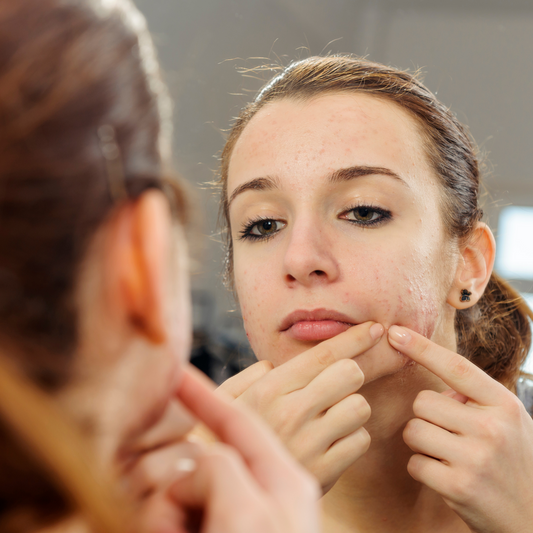Understanding the Comedogenic Rating Scale