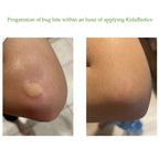 KidzBiotics Natural Probiotic Skin Care Spray for Kids Siani Probiotic Body Care
