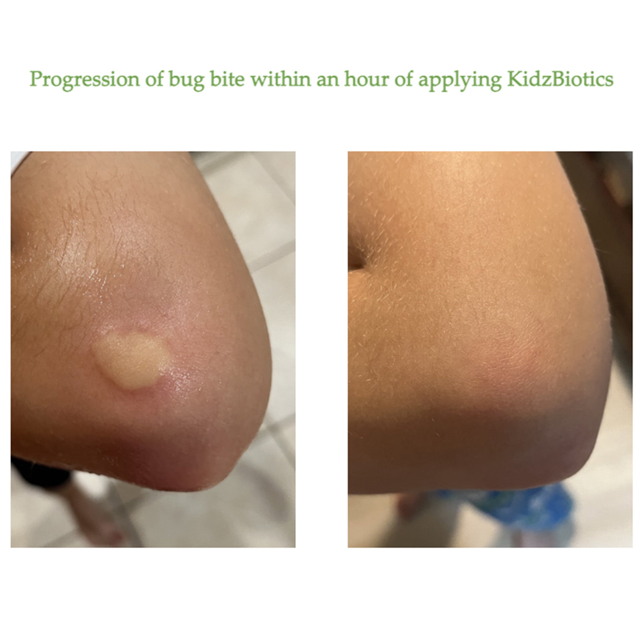 KidzBiotics Natural Probiotic Skin Care Spray for Kids Siani Probiotic Body Care