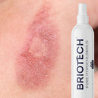 Pure Hypochlorous Acid Spray (Topical) Briotech